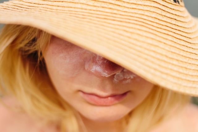 日焼けした皮膚の皮むけ対処方法と再生にかかる期間＆ケア方法