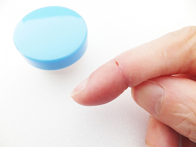 指先ぱっくり割れの原因と治し方,予防方法や絆創膏の効果は？
