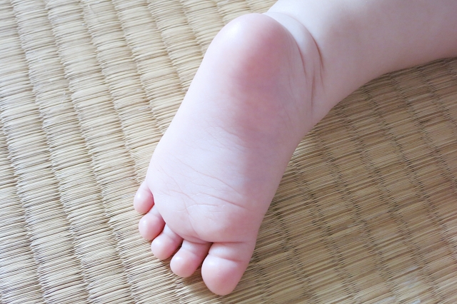 赤ちゃんが蚊に刺された時 跡が消えない時の対処と病院受診の皮膚状態